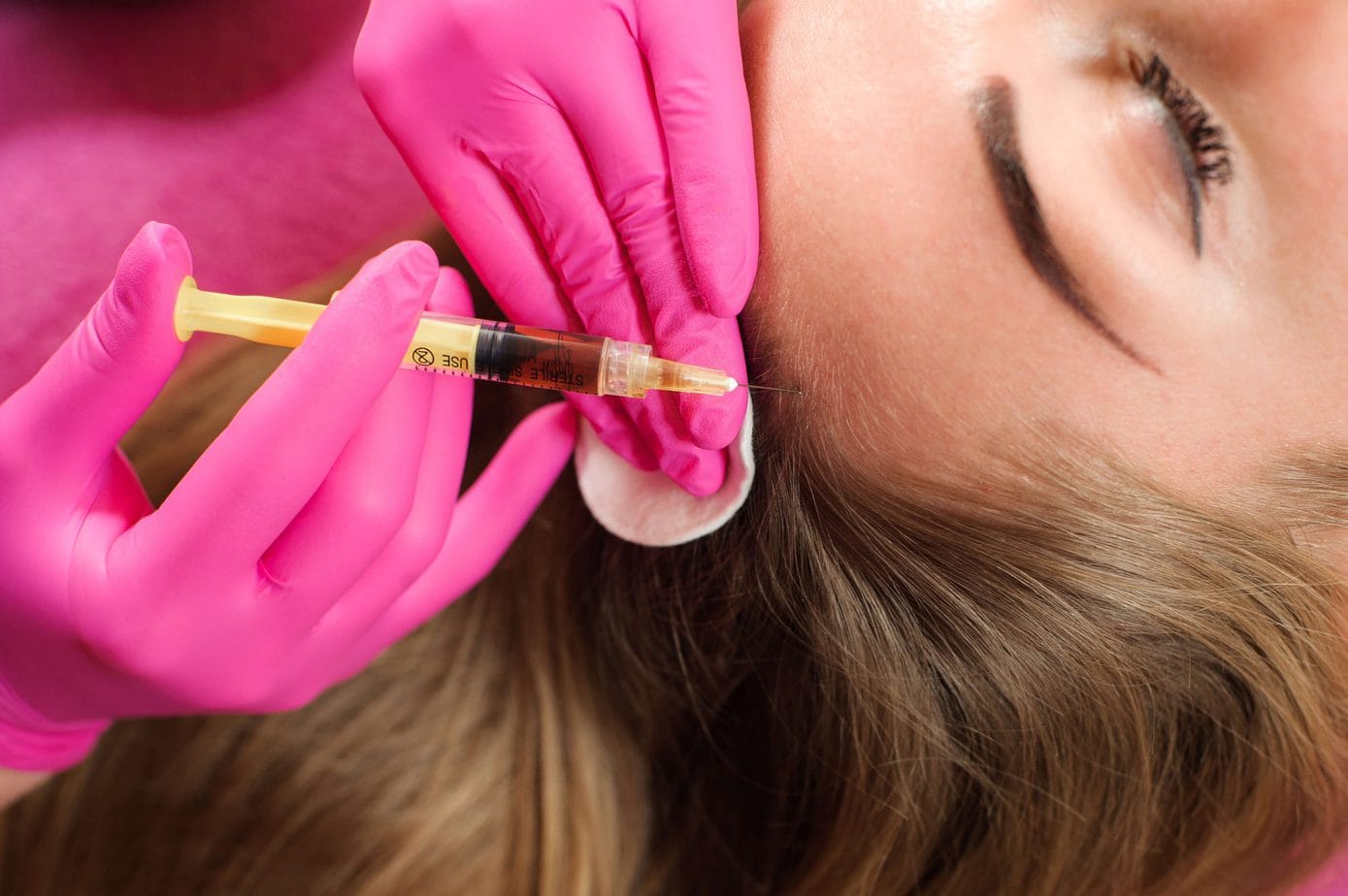 <strong>Needle mesotherapy of the scalp – </strong> what should you know about it?