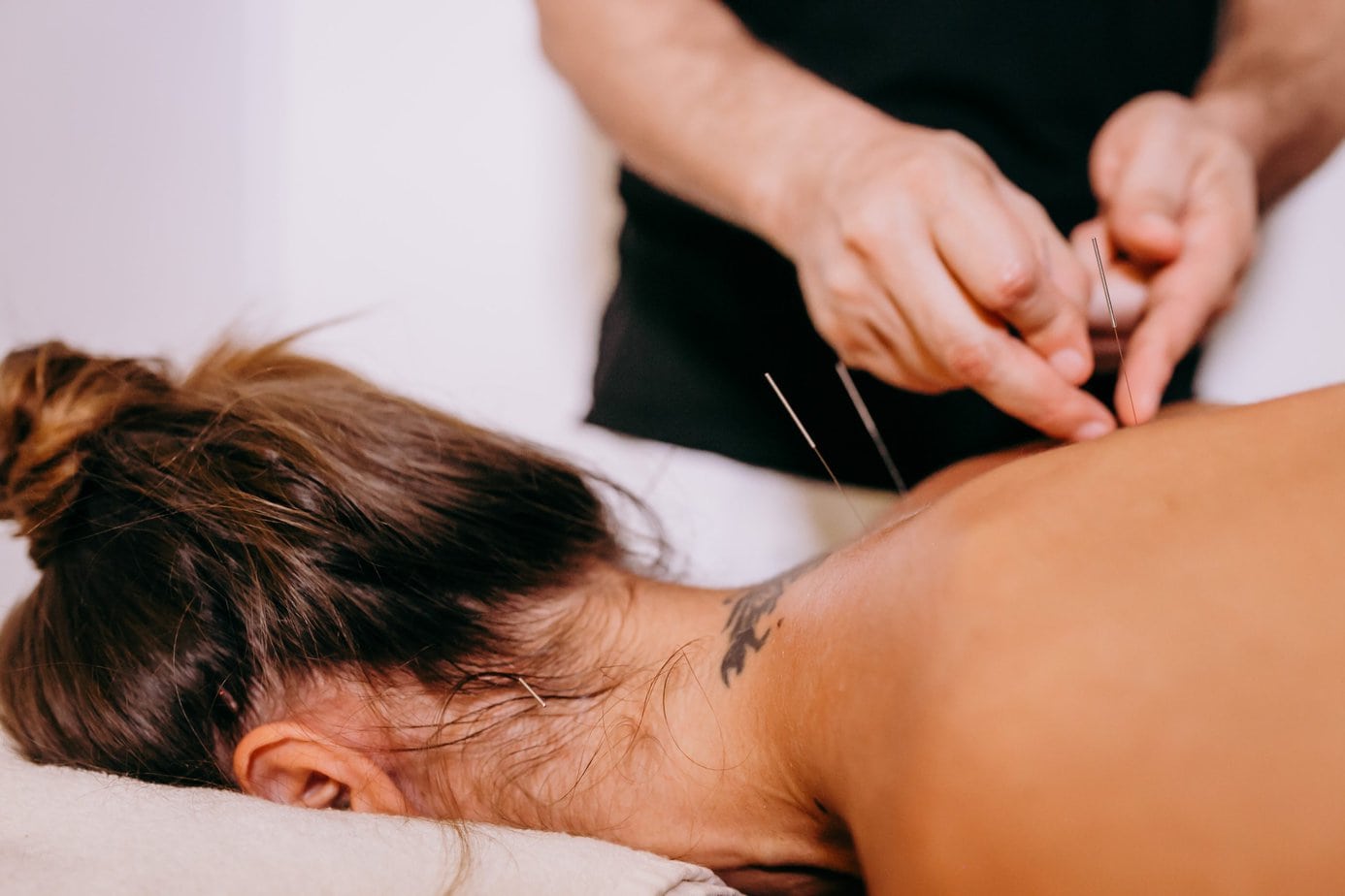 Unveiling the Secrets of Acupuncture: Prolonging the Effectiveness of Treatment